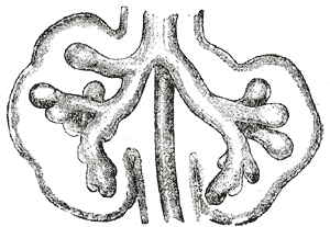 Gray's Anatomy illustration of a Pacinian corpuscle (lamellar corpuscle) in the hypodermis
