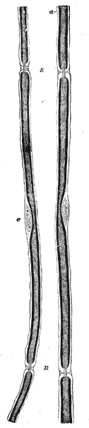 Gray's Anatomy illustration of the cerebellum