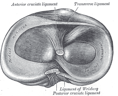 Diagram of rheumatoid arthritis joint pathology