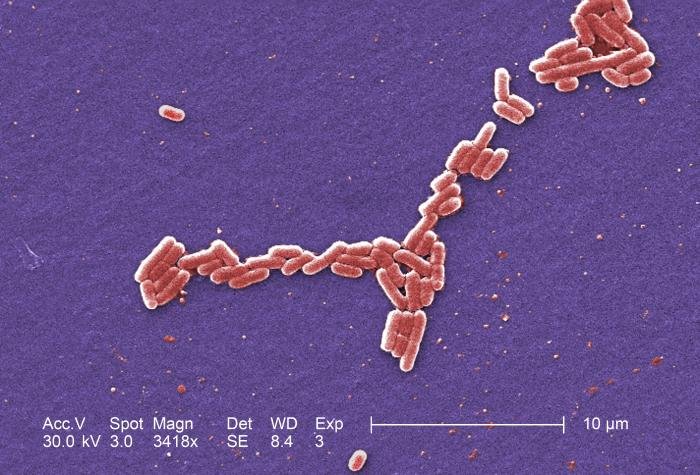 Scanning electron micrograph of E. coli bacteria